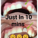 Missing Tooth to Fix Tooth just in 10 mins