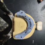 Full Mouth Dental Implants Prosthetic Phase