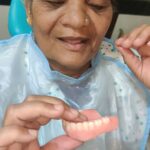 One Hour/ Two Visit Complete Removable Denture Technique