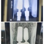Radiographs B4 & After on 1 Piece Hybrid Dental Implant