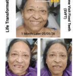 Superfast Dental Implantology