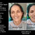 Same Visit Fixed Tooth (SVFT) in 10 Just Mins