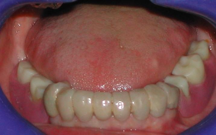 Dental Pictures 119 a