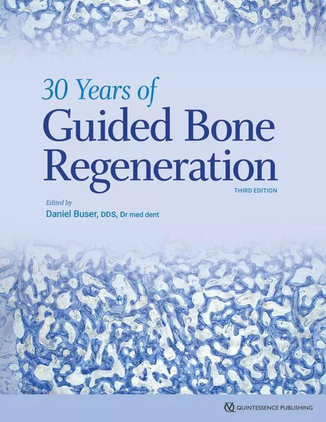 Book on 30 YEARS OF GUIDED BONE REGENERATION