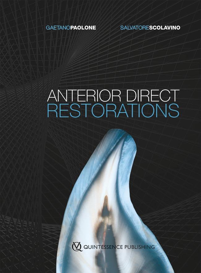 A book on ANTERIOR DIRECT RESTORATIONS