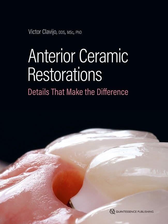 A book on ANTERIOR CERAMIC RESTORATIONS