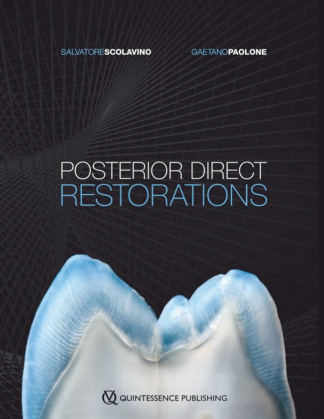 A book on POSTERIOR DIRECT RESTORATIONS
