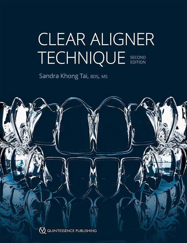 Clear ALigner Techhnique