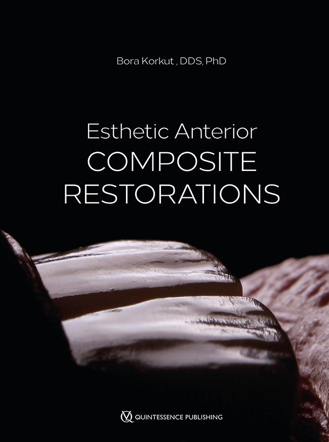 A book on ESTHETIC COMPOSITE RESTORATIONS