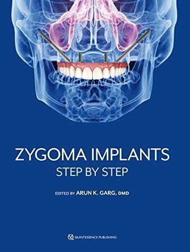 A book on ZYGOMA IMPLANTS STEP by STEP