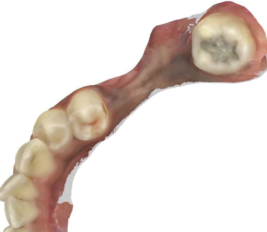 gallery_penta_lower_m