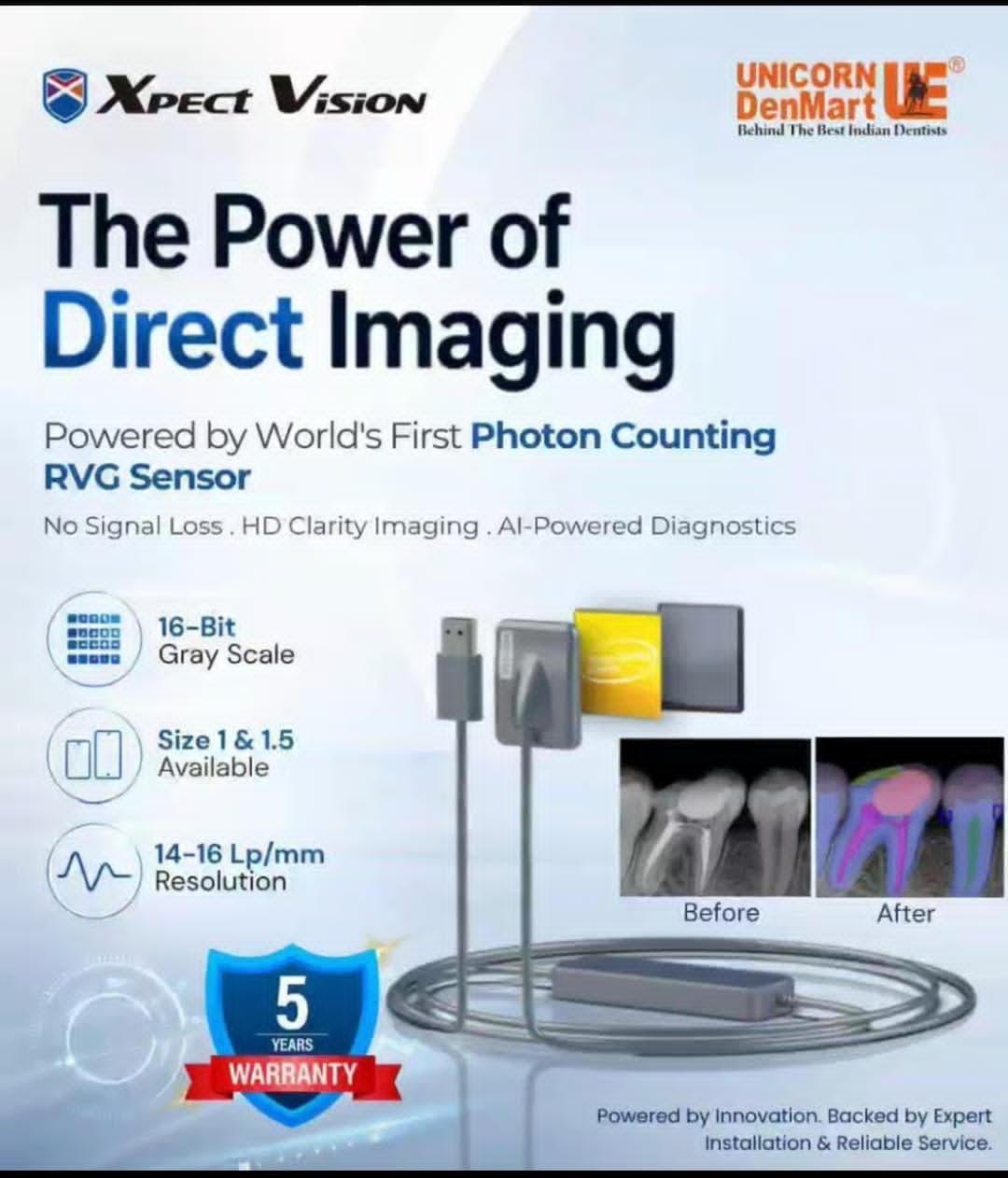 World’s first photon counting RVG sensor