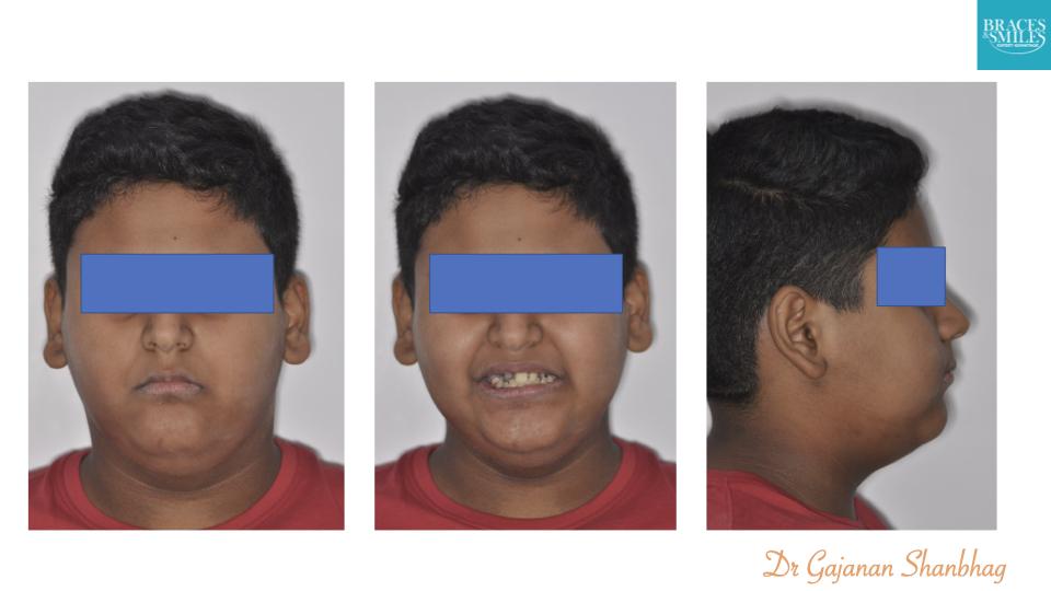 RAJVEER PRADHAN.008