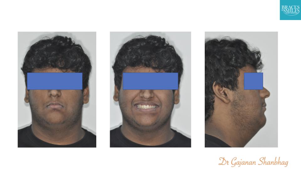RAJVEER PRADHAN.013